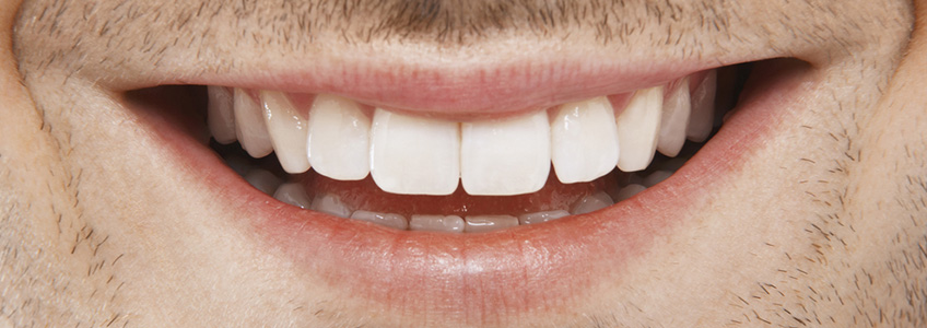 Ağız ve Diş Sağlığı, Ankara Diş Tedavileri