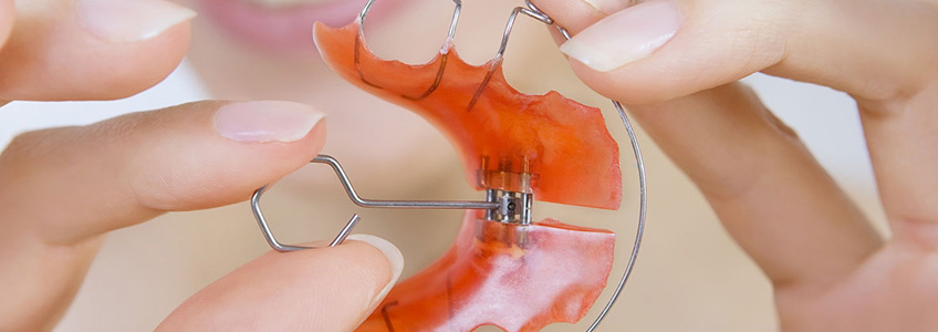 Hareketli, Fonksiyonel ve Ağız Dışı Apareylerle Ortodontik Tedavi