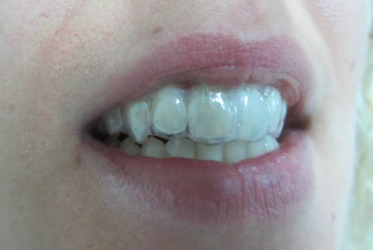 telsiz ortodonti
